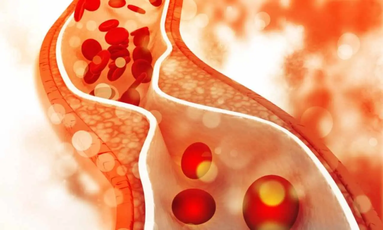 Cinque sintomi dell'angina pectoris che non puoi permetterti di ignorare 3 Immagine selezionata