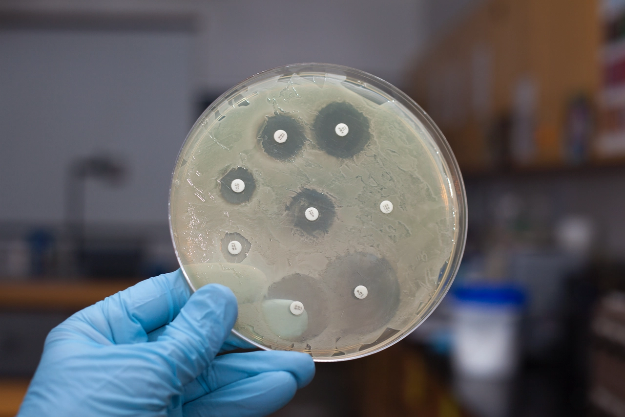 Scienziati in allerta il batterio killer resiste sempre di più agli antibiotici 5 Immagine selezionata